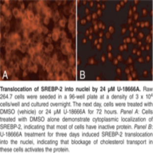 SREBP-2 Cell-Based Translocation Assay Kit