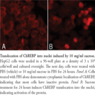 ChREBP Cell-Based Translocation Assay Kit