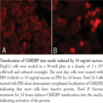 ChREBP Cell-Based Translocation Assay Kit