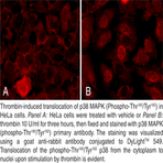 p38 MAPK (Phospho-Thr180/Tyr182) Cell-Based Phosphorylation/Translocation Assay Kit