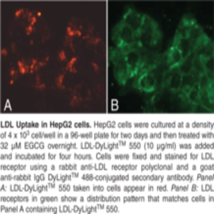 LDL Uptake Cell-Based Assay Kit