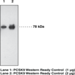 PCSK9 Monoclonal Antibody (Clone 15A6)