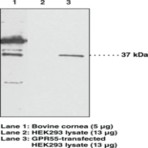 GPR55 Polyclonal Antibody