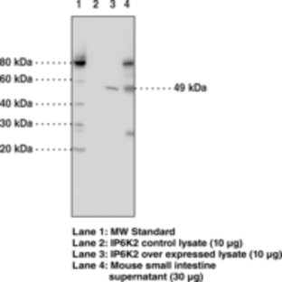 IP6K2 Monoclonal Antibody (Clone 4F10)