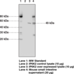 IP6K2 Monoclonal Antibody (Clone 4F10)