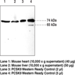 PCSK9 Polyclonal Antibody