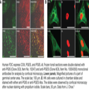 Prostaglandin I Synthase Monoclonal Antibody (Clone 3C8)