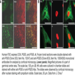 Prostaglandin I Synthase Monoclonal Antibody (Clone 3C8)