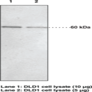 JMJD2D Polyclonal Antibody