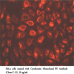 Cytokeratin Monoclonal PE Antibody (Clone C-11)