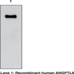 ANGPTL6 (human) Monoclonal Antibody (Clone Kairos-60)