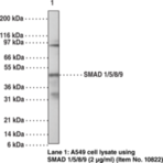 SMAD1/5/8/9 Polyclonal Antibody