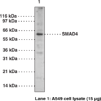 SMAD4 Polyclonal Antibody