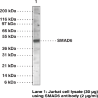 SMAD6 Polyclonal Antibody