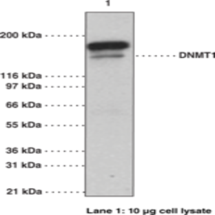 DNA Methyltransferase 1 Monoclonal Antibody (Clone 60B1220.1)