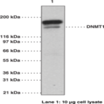 DNA Methyltransferase 1 Monoclonal Antibody (Clone 60B1220.1)