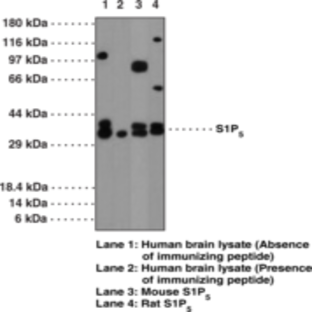 S1P5 Polyclonal Antibody