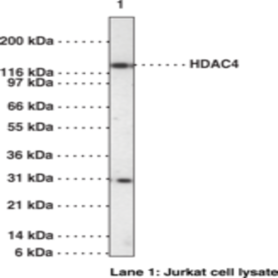 HDAC4 Polyclonal Antibody