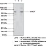 BRD4/HUNK1 Polyclonal Antibody