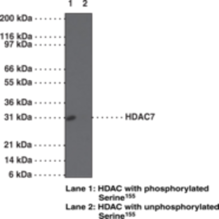 HDAC7 (Phospho-Ser155) Polyclonal Antibody