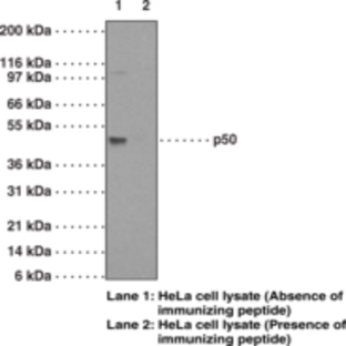 NF-kB (p50) Monoclonal Antibody (Clone 2J10D7)