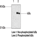 IkB(alpha) (Phospho-Ser32/36) Monoclonal Antibody (Clone 39A1413)