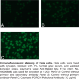 PORCN Polyclonal Antibody