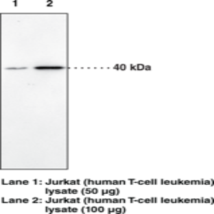 CB2 Receptor Polyclonal Antibody