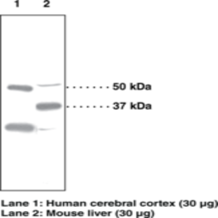 PPAR(delta) Polyclonal Antibody