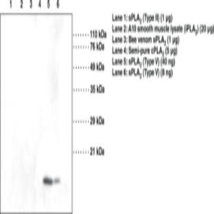 sPLA2 (human Type V) Monoclonal Antibody (Clone MCL-3G1)