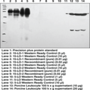 15-Lipoxygenase-1 (rabbit) Polyclonal Antiserum