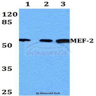 MEF-2 (P313) pAb