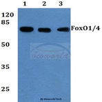 FoxO1/3/4 (P18) pAb