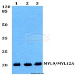 MYL9/MYL12A (P13) pAb