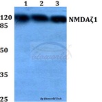 NMDA?1 (S885) pAb