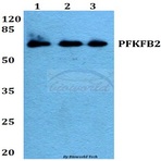 PFKFB2 (P479) pAb