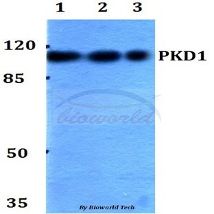 PKD1 (R201) pAb