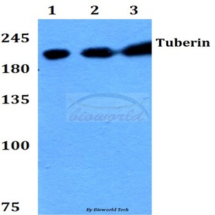 Tuberin (F933) pAb