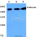 Tuberin (F933) pAb