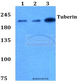 Tuberin (L1456) pAb