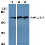 PAK1/2/3 (K140) pAb