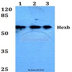 Hexb (S516) pAb