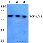 TCF-4/12 (S616) pAb