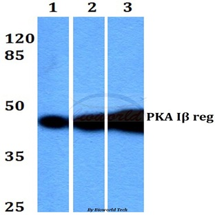 PKA I(beta) reg (F138) pAb