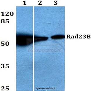 Rad23B (K27) pAb