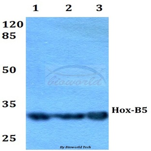 Hox-B5 (T199) pAb