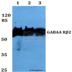 GABAA R(beta)2 (R431) pAb