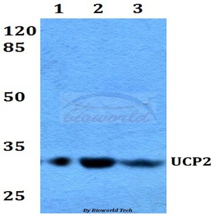 UCP2 (H113) pAb