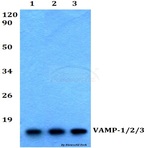 VAMP-1/2/3 (D70) pAb