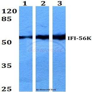 IFI-56K (H63) pAb